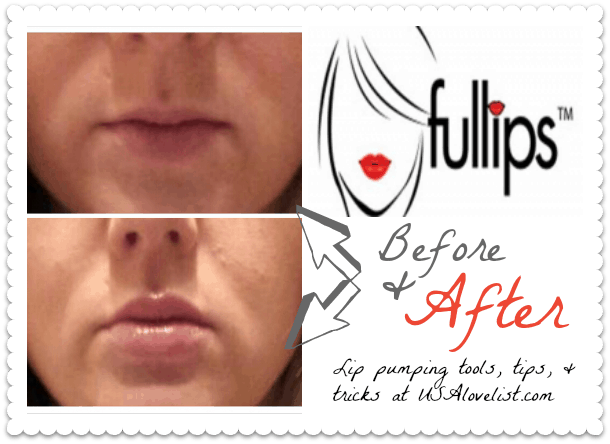 fullips-lip-enhancement